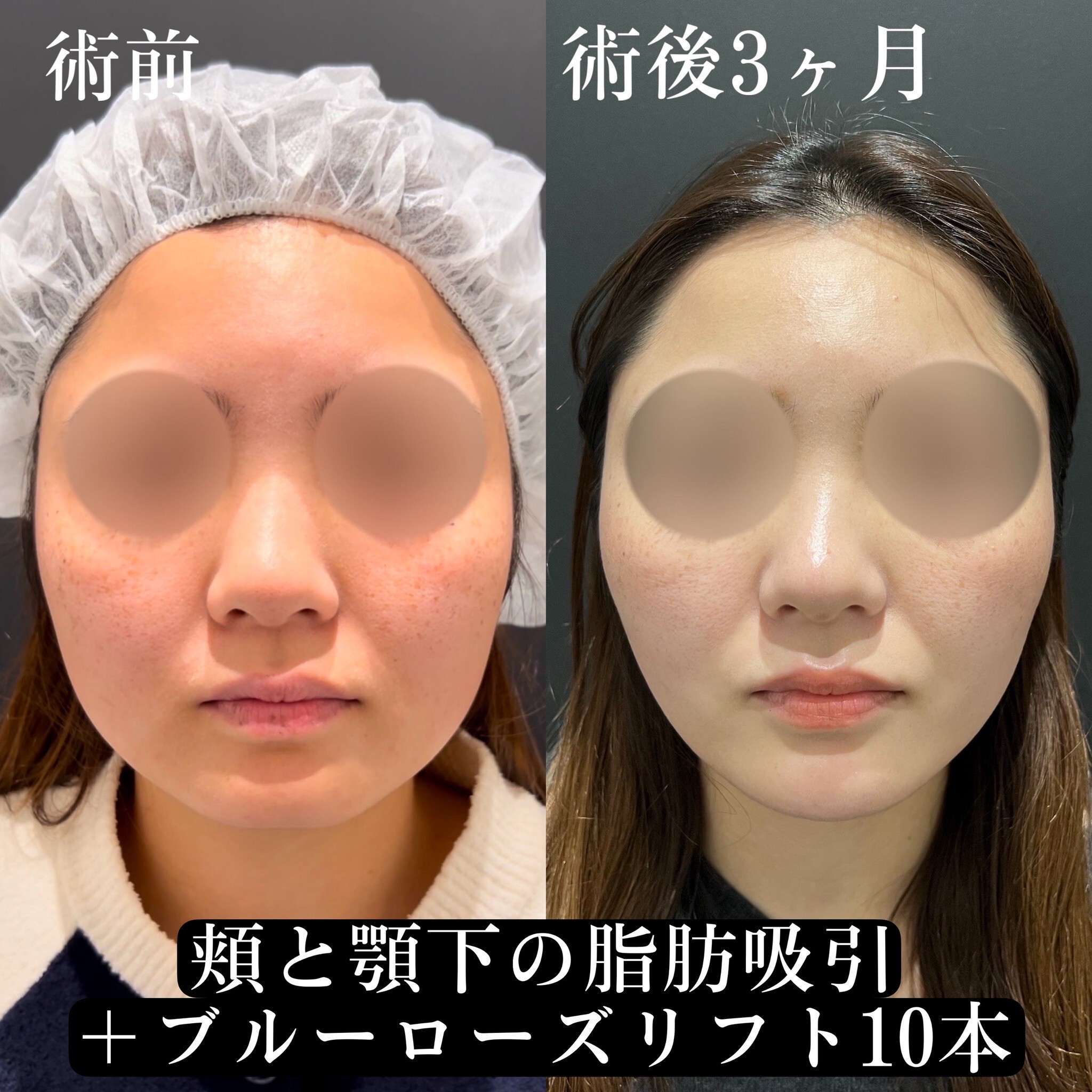 症例写真20