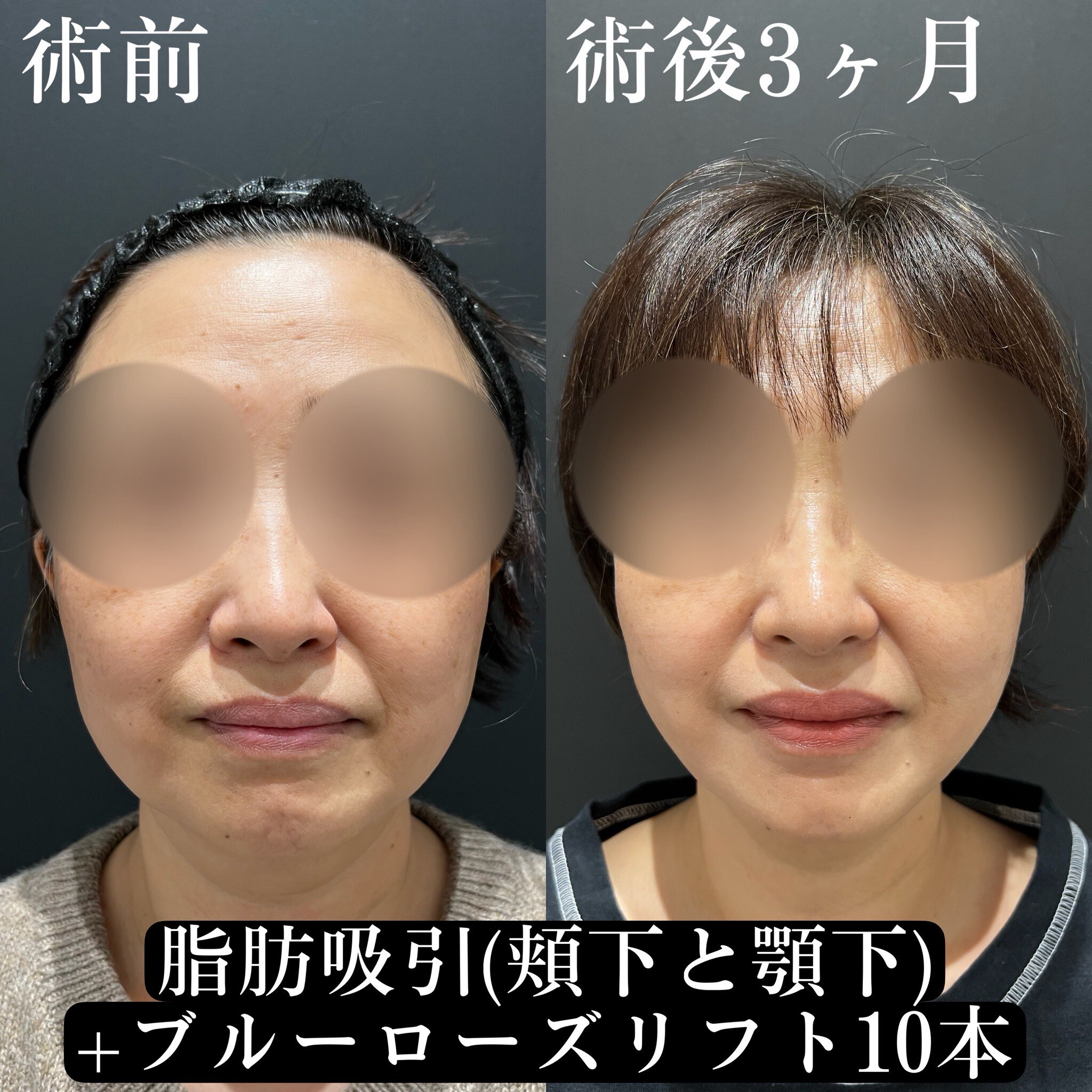 症例写真21