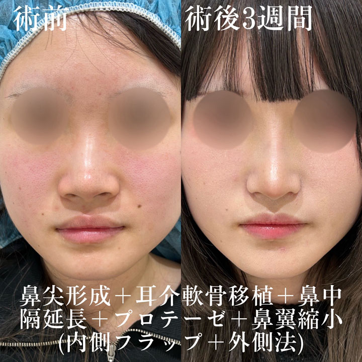 症例写真22