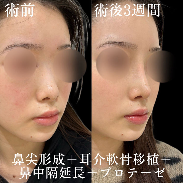 症例写真23