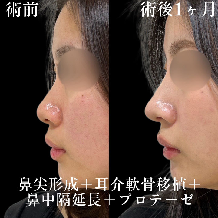 症例写真24