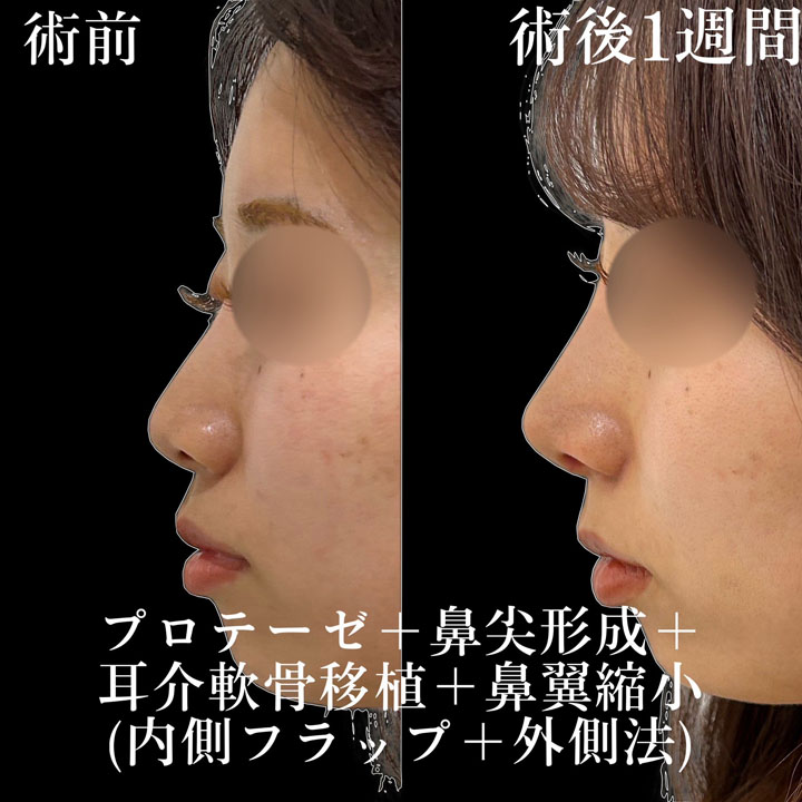 症例写真26