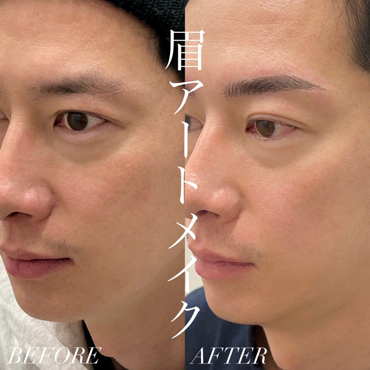 症例写真27